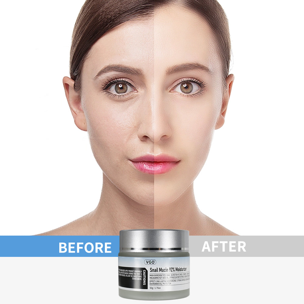 Snail Mucin 92% Moisturizer: Rejuvenate and Nourish Your Skin